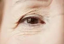 Bila Mengalami Penuaan Dini, Jangan Salahkan Matahari