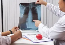 TBC di Nunukan Meningkat, Dinkes Temukan 545 Kasus  